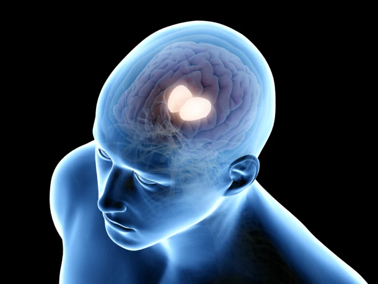 How To Identify Wet Brain & Its Symptoms